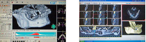 �C���v�����gCT�f�f