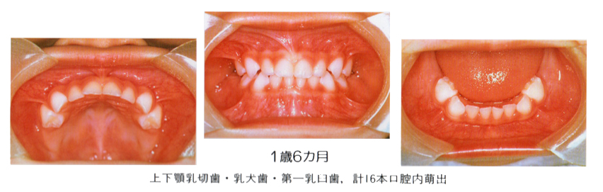 �����旧�΂̎���� �������� �q���̌��P�Δ�