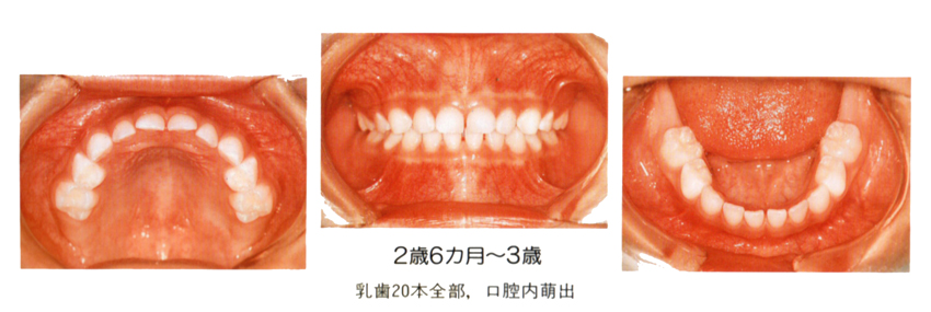 �����旧�΂̎���� �������� �q���̌��R��