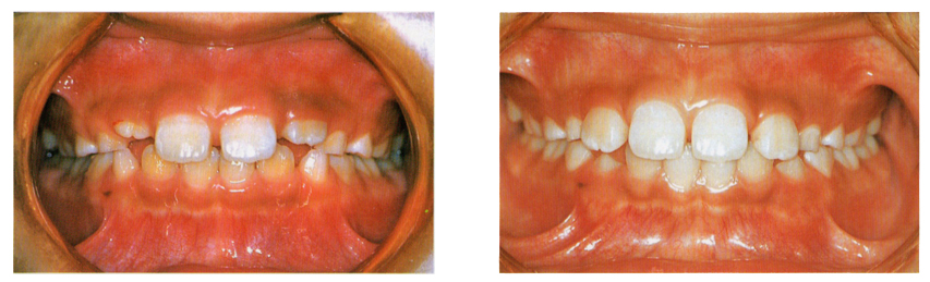 �����旧�΂̎���� �������� �q���̌��W��