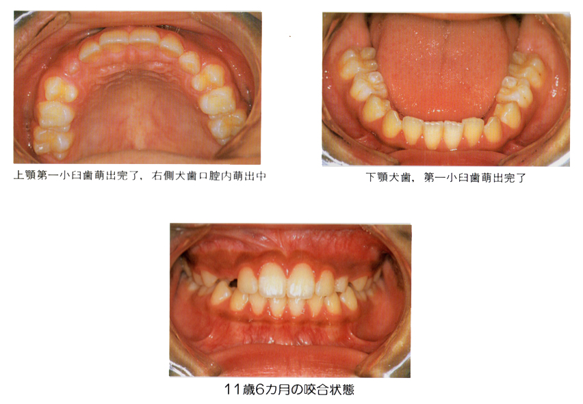 �����旧�΂̎���� �������� �q���̌��P�P��