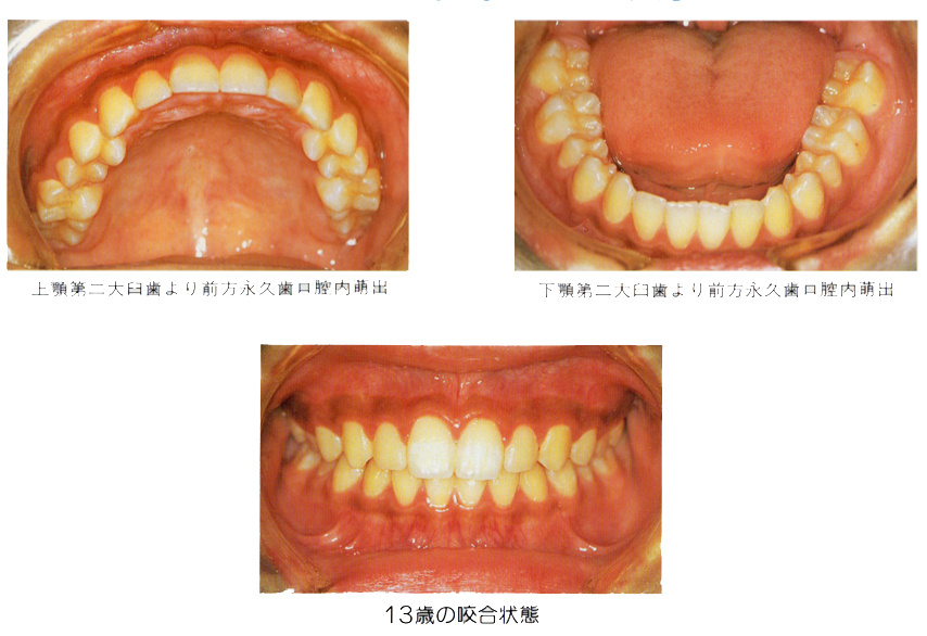 �����旧�΂̎���� �������� �q���̌��P�R��