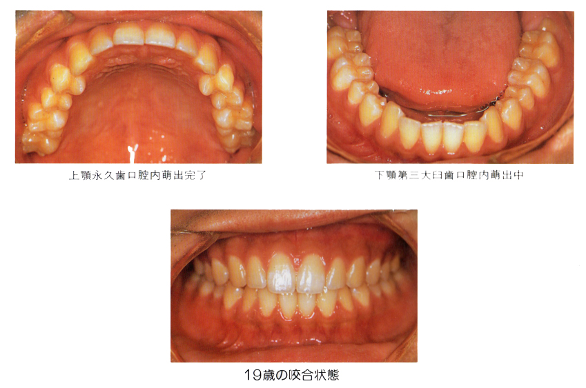 �����旧�΂̎���� �������� �q���̌��P�X��