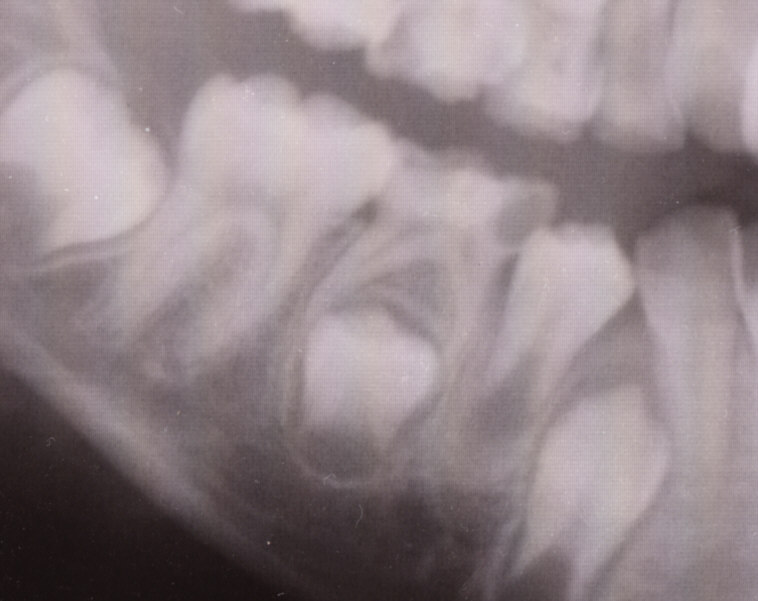 �����旧�΂̎���� �������� �q���̃����g�Q��