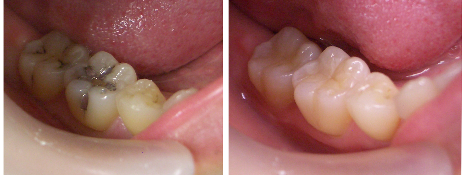 葛飾区立石高見歯科クリニック・審美歯科１