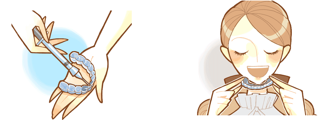 ホームホワイトニング